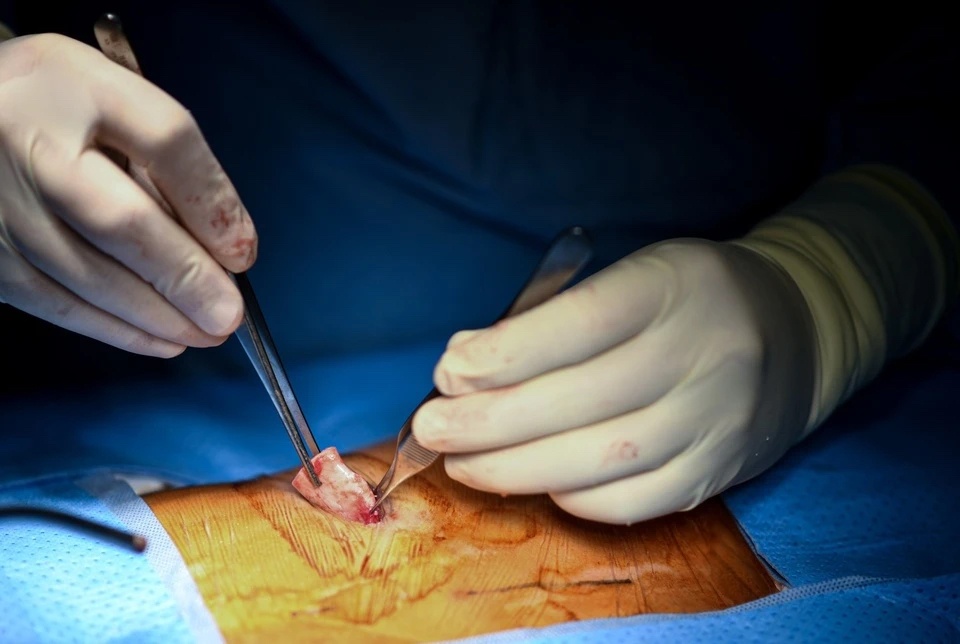 Co gai 28 tuoi nguy kich trong ban phau thuat nang mui hinh anh