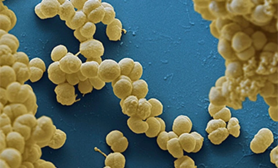 Nhung dieu can biet ve benh nao mo cau hinh anh