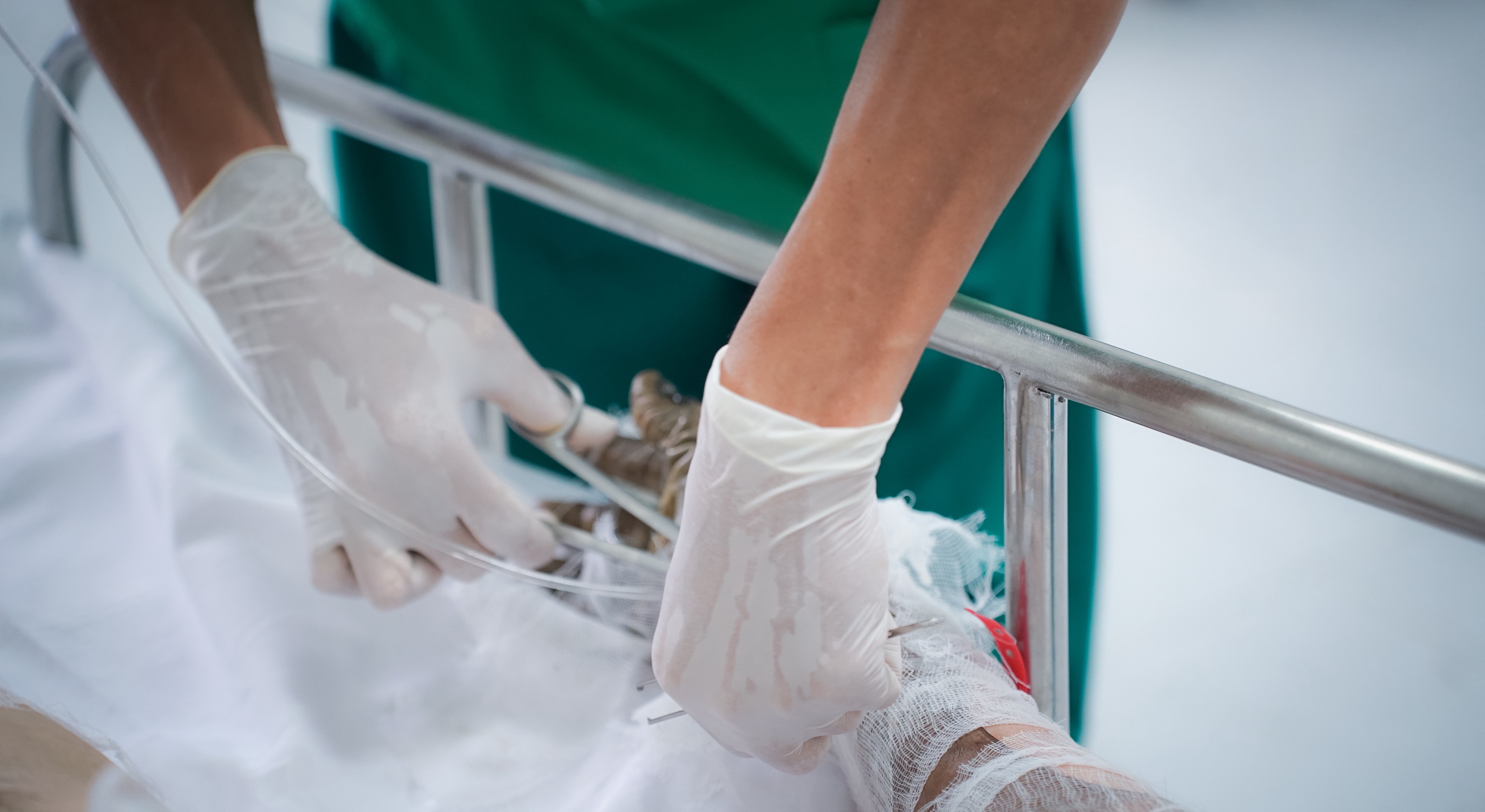 Tinh hinh 2 nan nhan vu chay chung cu o quan 1, TP.HCM hinh anh