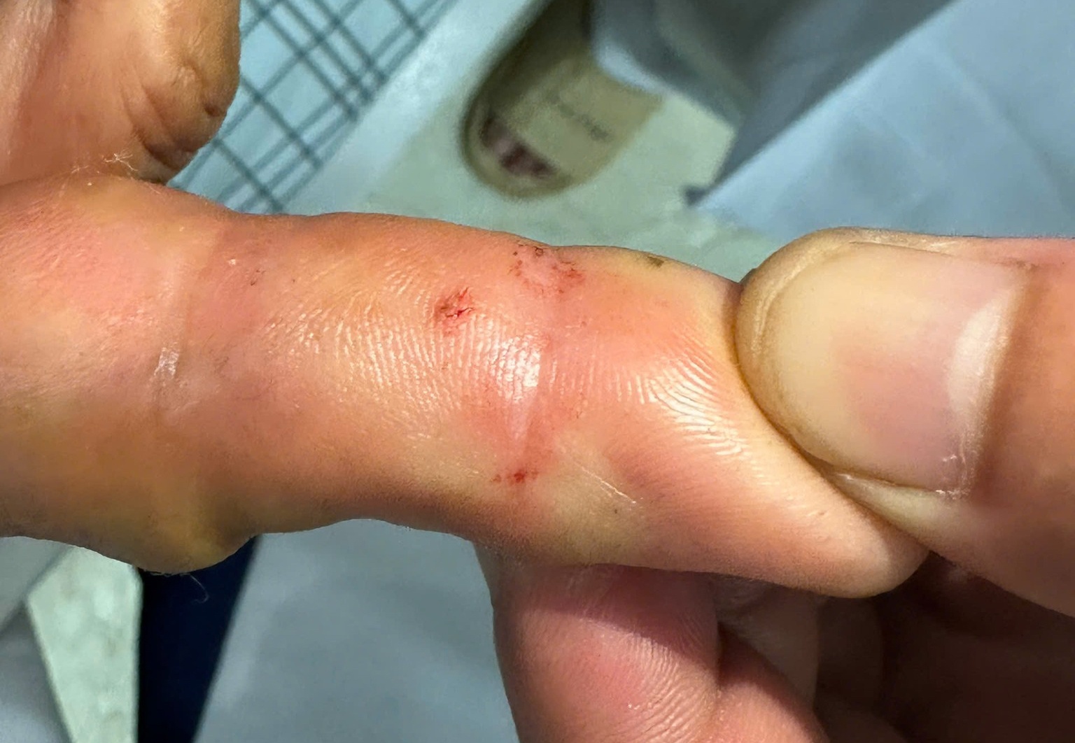 Them mot nguoi bi ran ho mang can hinh anh