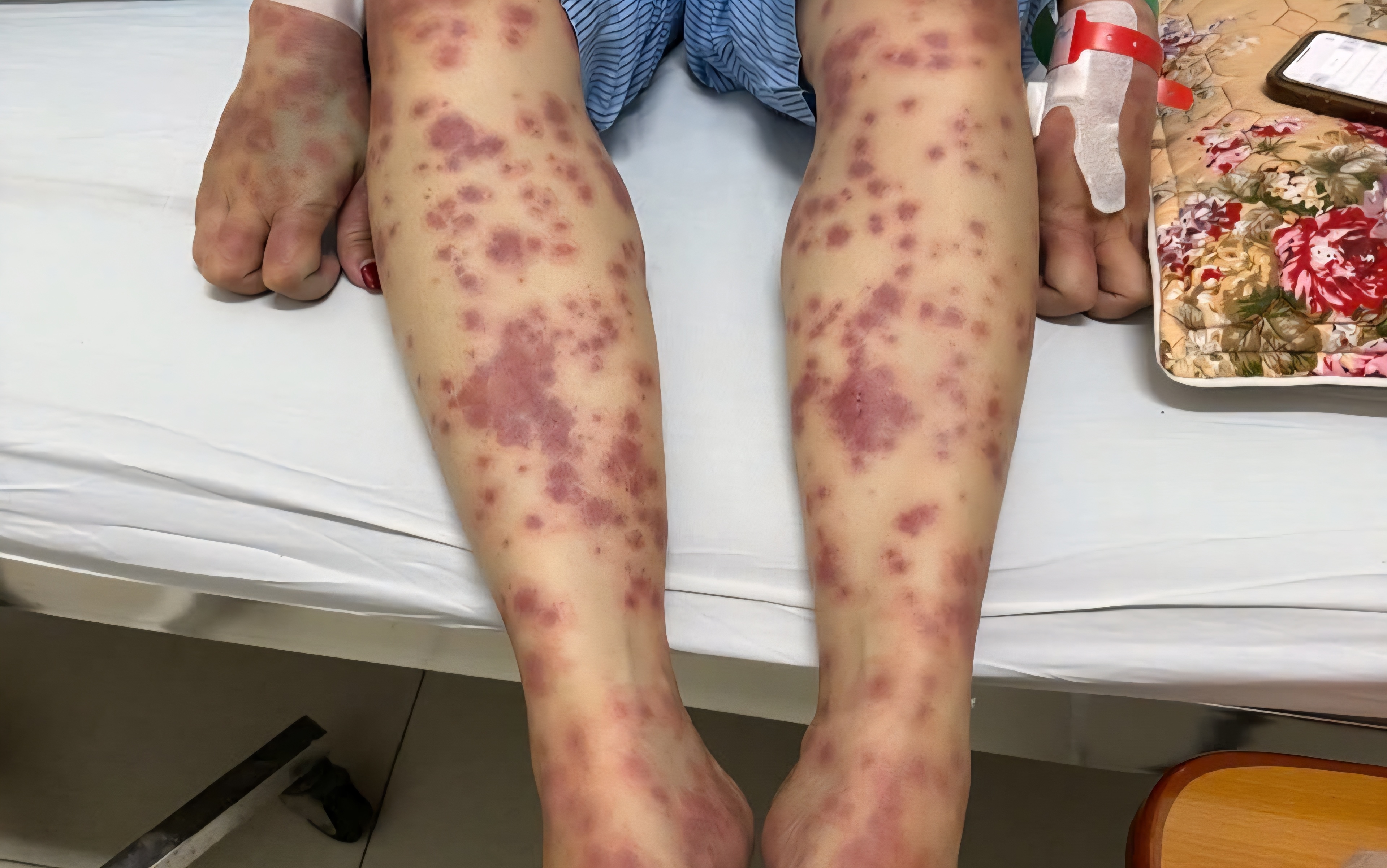 Nu benh nhan nguy kich vi thuoc giam can khong ro nguon goc hinh anh