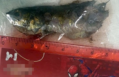 Con ca ro song chui tot vao hong be trai 4 tuoi hinh anh