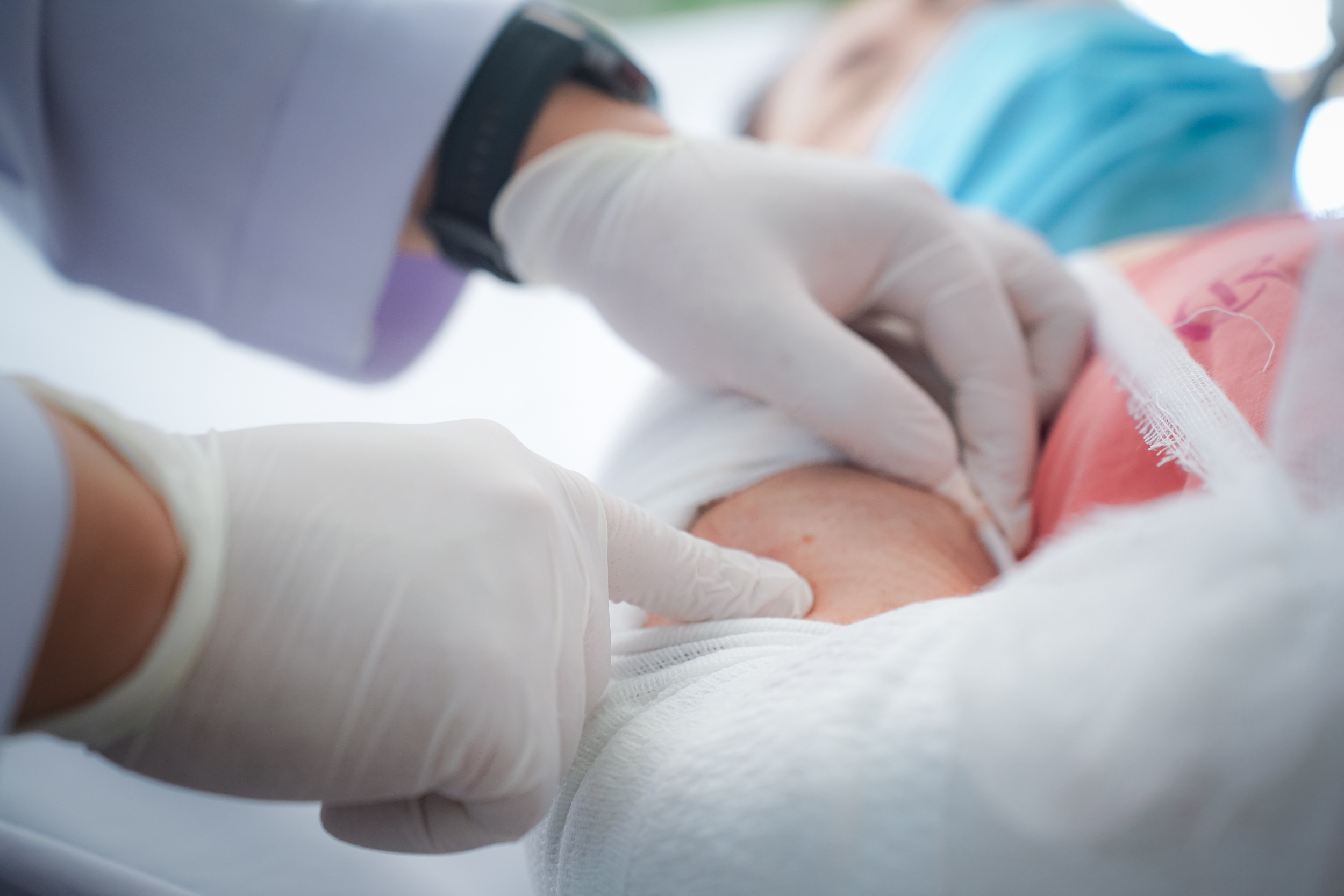 Tai nan cao toc lam 3 nguoi chet: Tinh hinh suc khoe cac nan nhan khac hinh anh