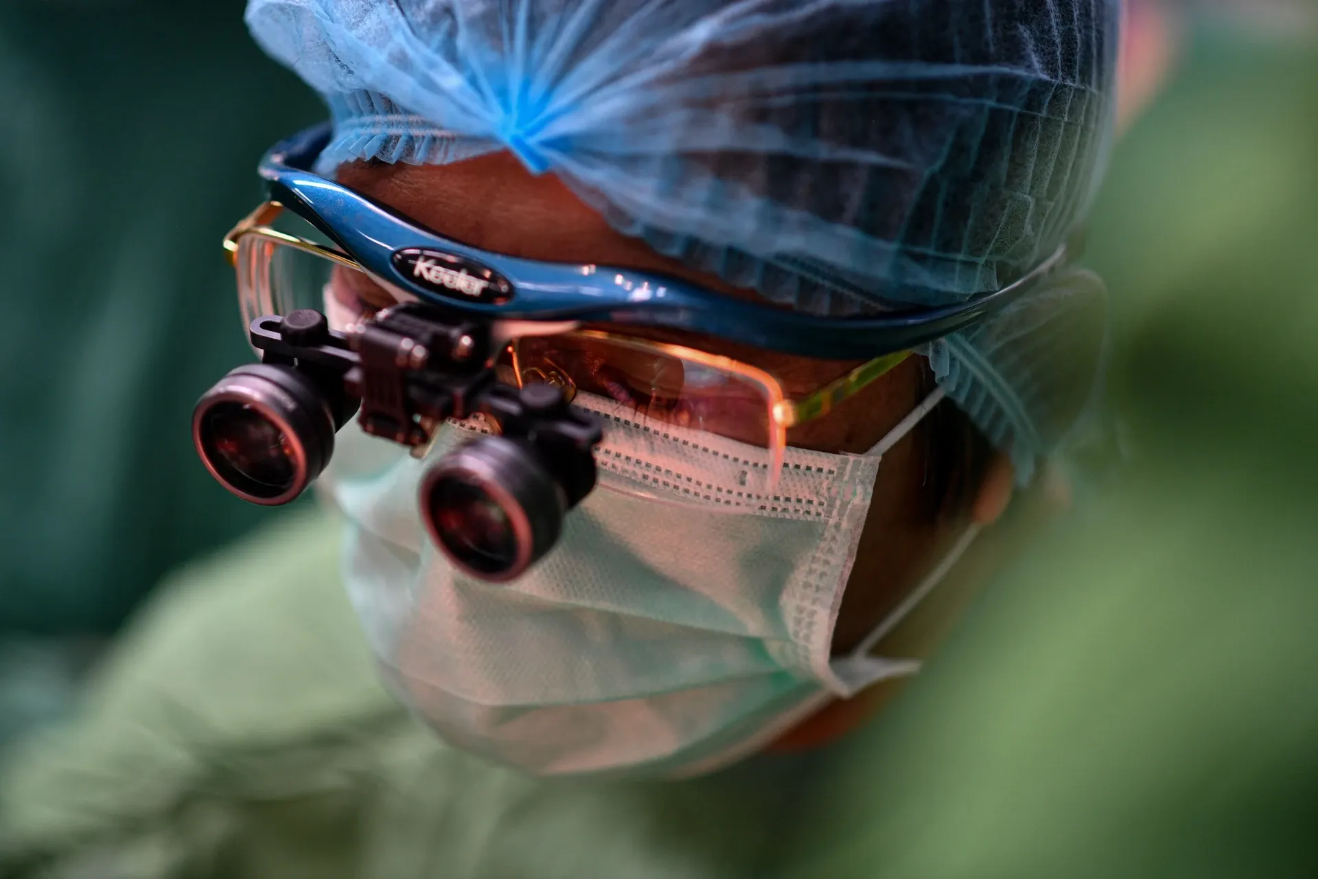 Nhung ca mo noi lien chi, da dau kinh dien hinh anh