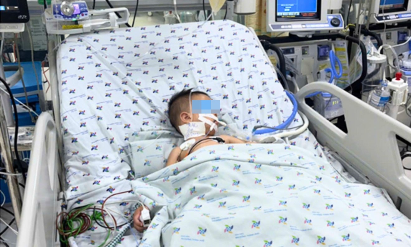 Cuu be trai 23 thang tuoi mac tay chan mieng do 3 nguy kich hinh anh