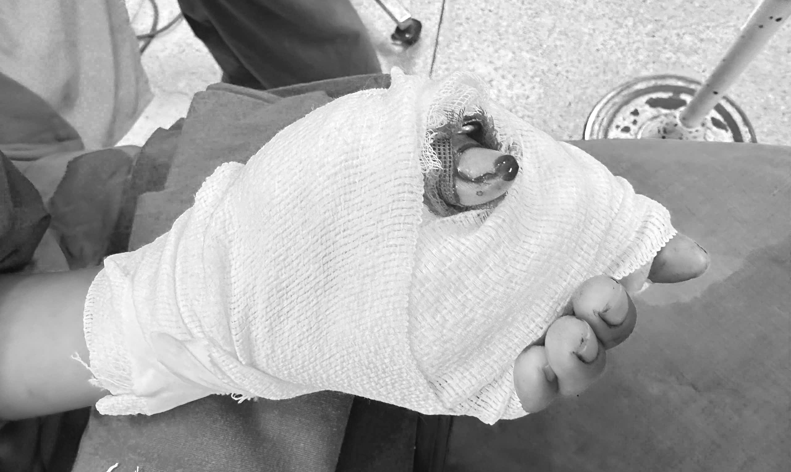 Be trai gap tai nan thuong tam khi phu me lam viec hinh anh