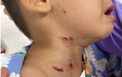 Be trai gap nan khi choi gan con cho dang ngu hinh anh