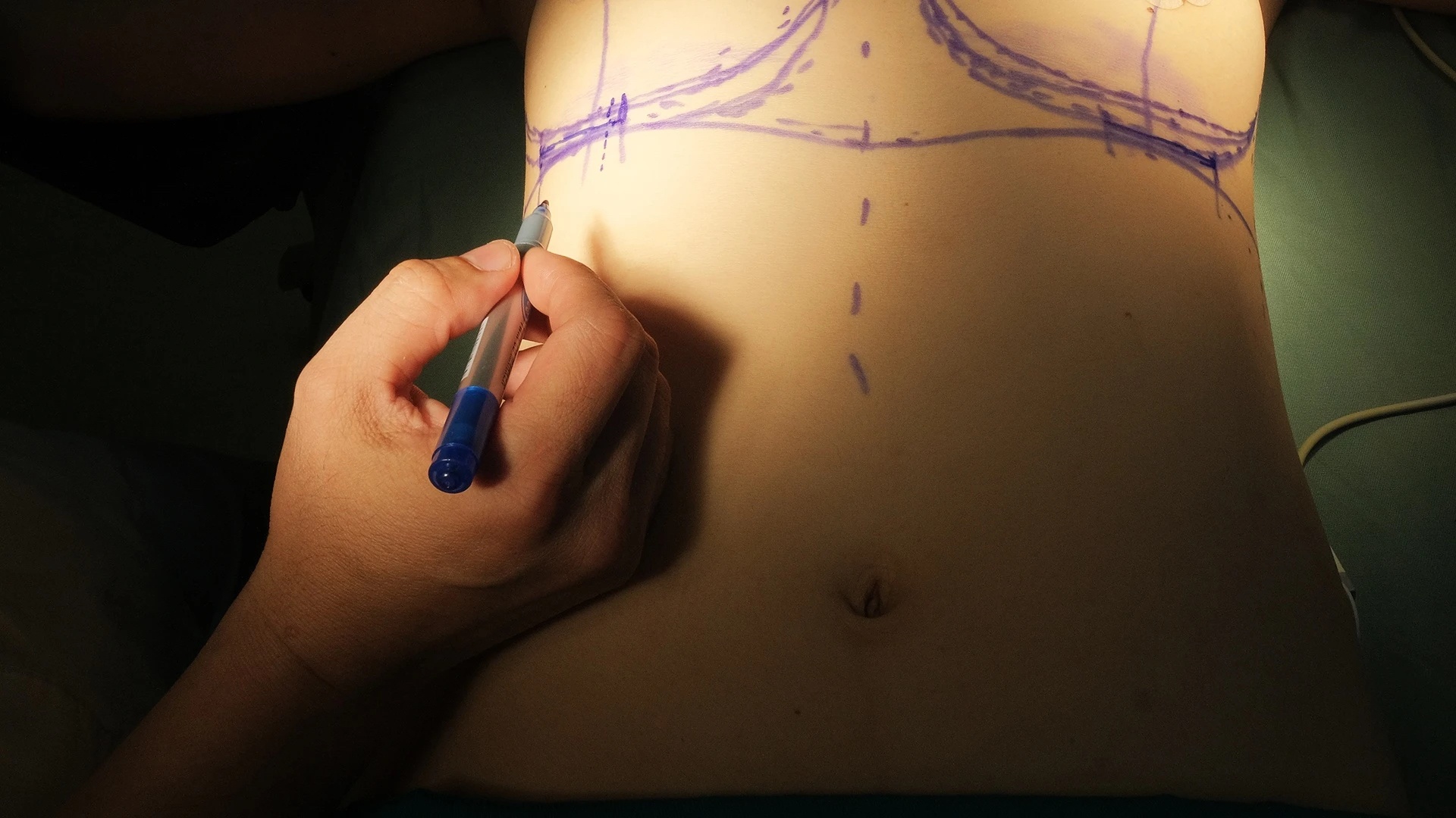 Phuong phap nang nguc duoc ua chuong nhat hinh anh