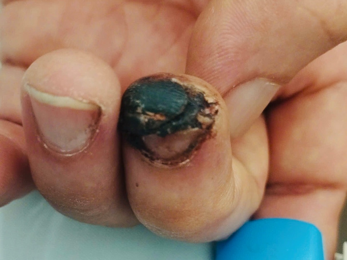 Vi sao uon van nguy hiem? hinh anh