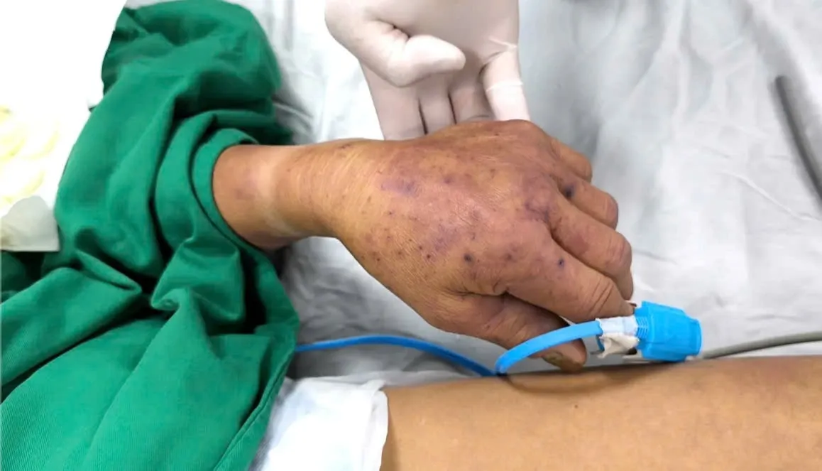 Bieu hien bat thuong sau bua an canh bao benh nguy hiem hinh anh