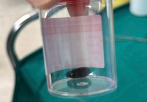 Be trai ganh hau qua nang ne vi gia dinh chu quan voi benh hinh anh