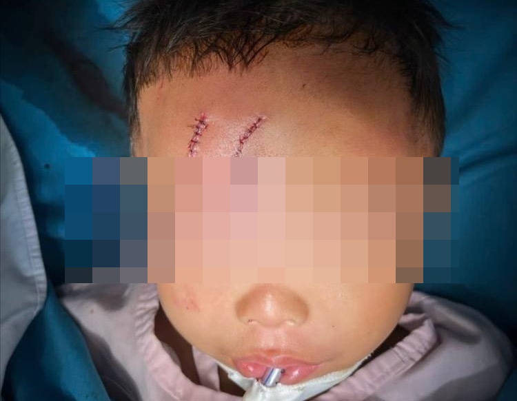 Be trai o TP.HCM bi cho becgie can thuong tam hinh anh