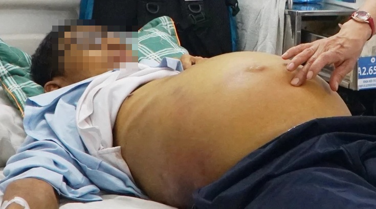 Be bang sau khi nhai voi vien An Cung phong dot quy hinh anh