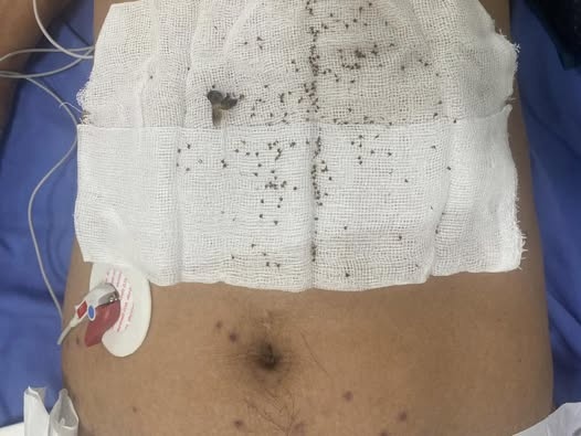 Bi hon 300 con ong khoai tan cong, nguoi dan ong suy da co quan hinh anh