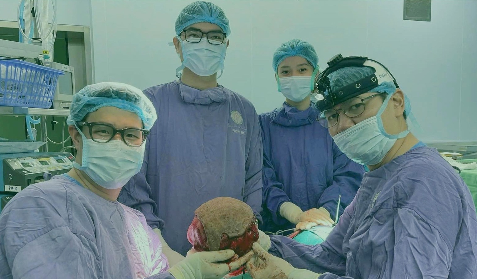 Khoi u khong lo bam hon 40 nam, an sau nua khuon mat benh nhan hinh anh