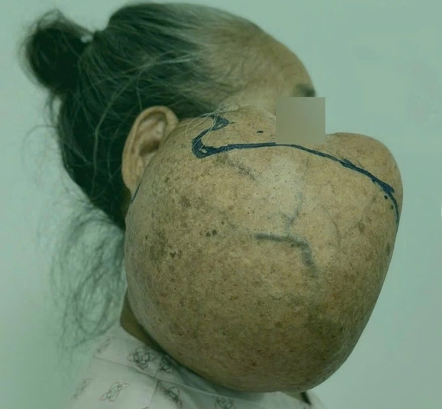 phẫu thuật hàm mặt ảnh 1 phau thuat ham mat anh 1