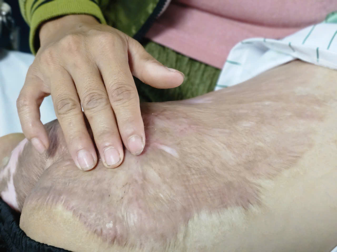 Hanh trinh tim lai su binh thuong sau noi dau cua nhung dua tre hinh anh