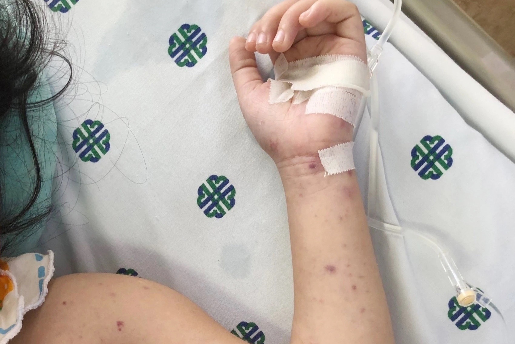 HCDC canh bao can benh nguy hiem, co the khong qua khoi sau vai gio hinh anh