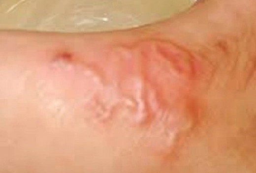 Hang nghin nguoi o Khanh Hoa mac can benh tu cho, meo hinh anh