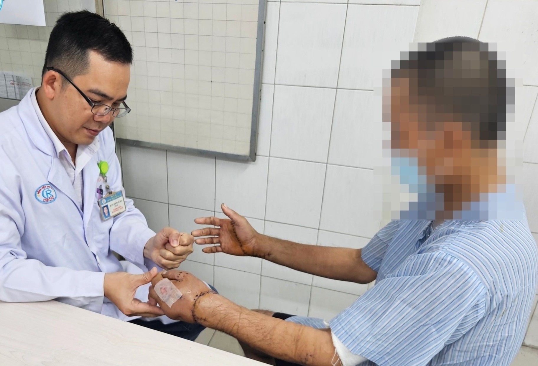 Nguoi dan ong 40 tuoi nhap vien voi ban tay bi chem dut lia hinh anh