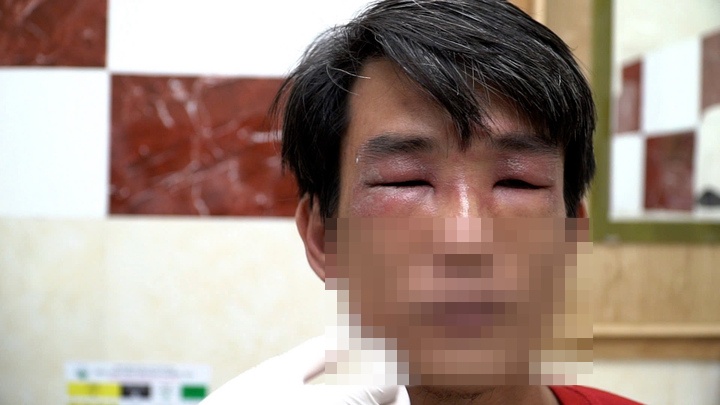 Kien ba khoang tan cong nguoi o TP.HCM hinh anh