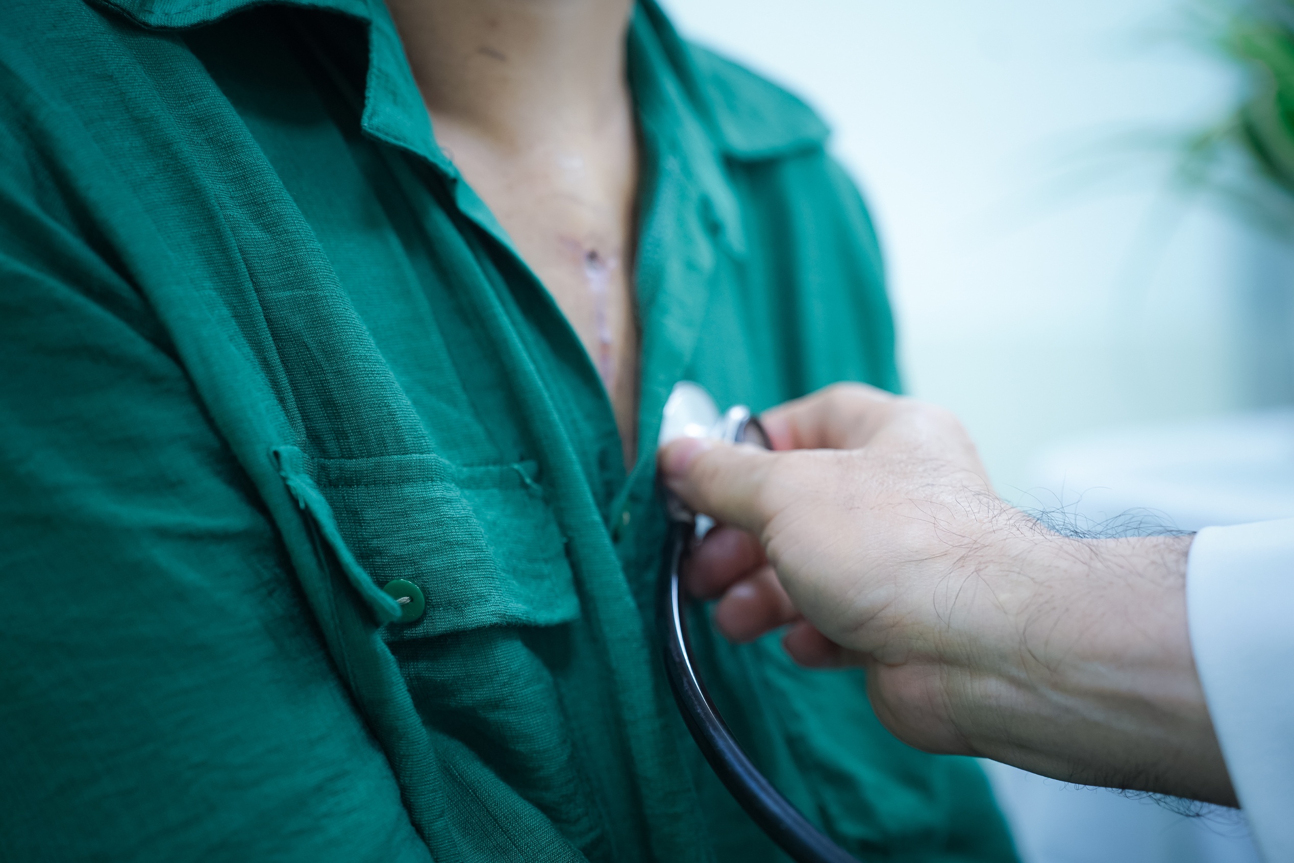 Hoi chung Marfan anh 1