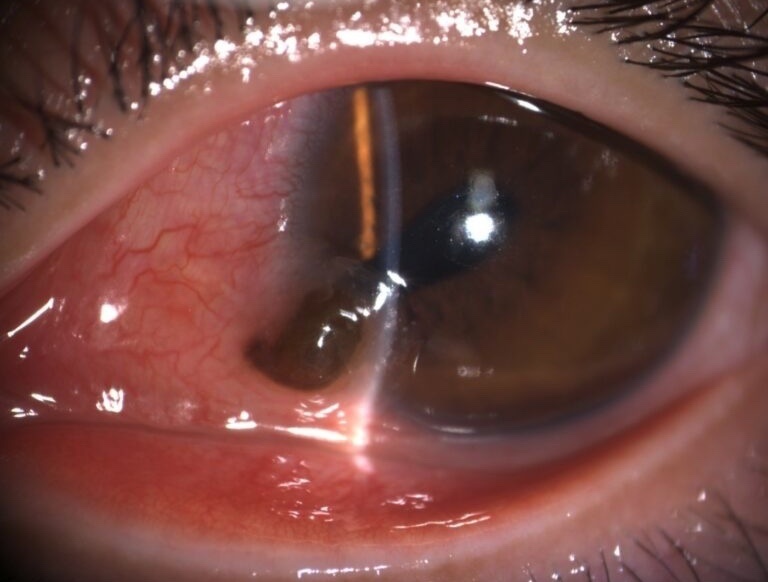 Nam thanh nien bi dinh ban xuyen mat khi dang lam viec hinh anh