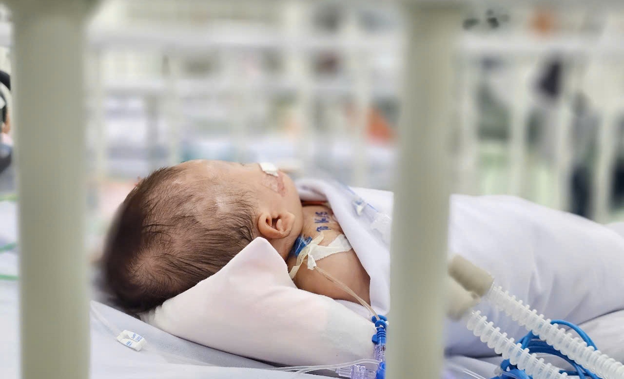 sot xuat huyet anh 1