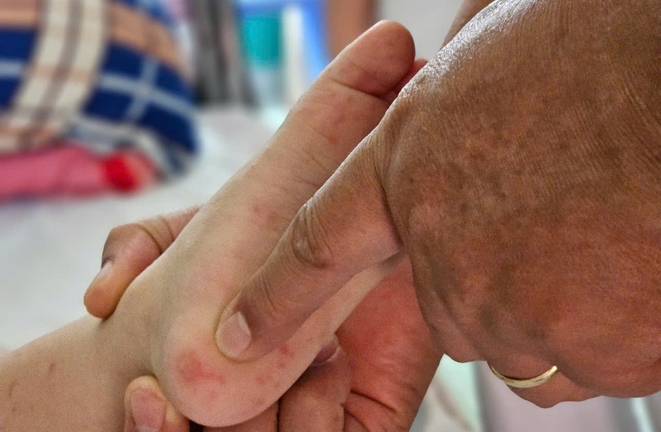 tay chan mieng anh 3