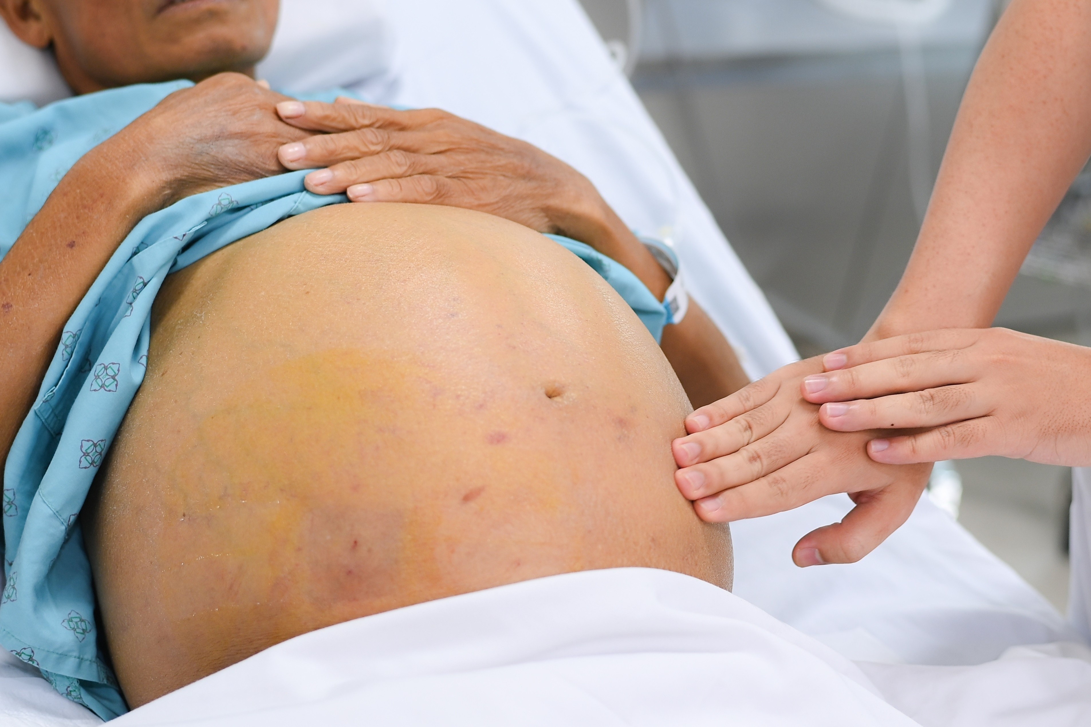 Can benh ve gan nguy hiem dang am tham de doa nguoi tre Viet hinh anh