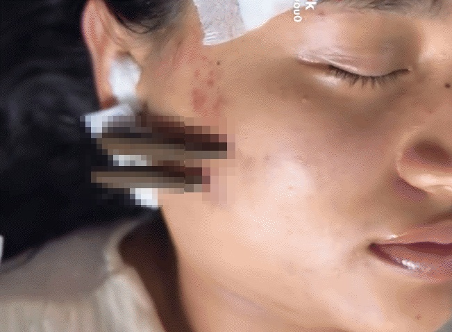 Clip dia 'hut doc' gay kinh hai MXH: Bac si len tieng hinh anh