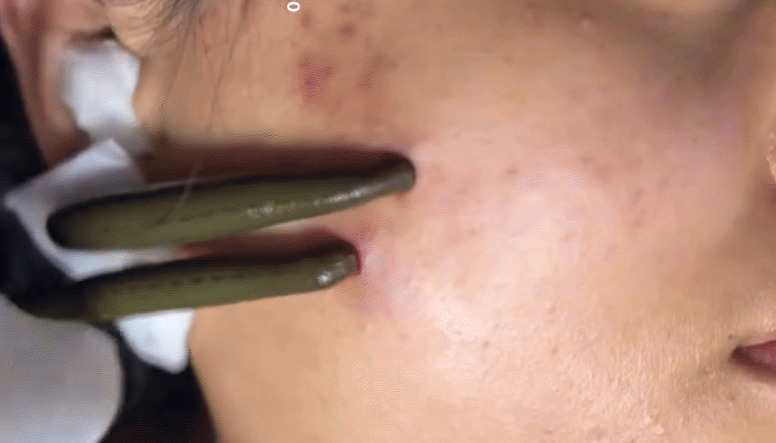 Clip dia 'hut doc' gay kinh hai MXH: Bac si len tieng hinh anh