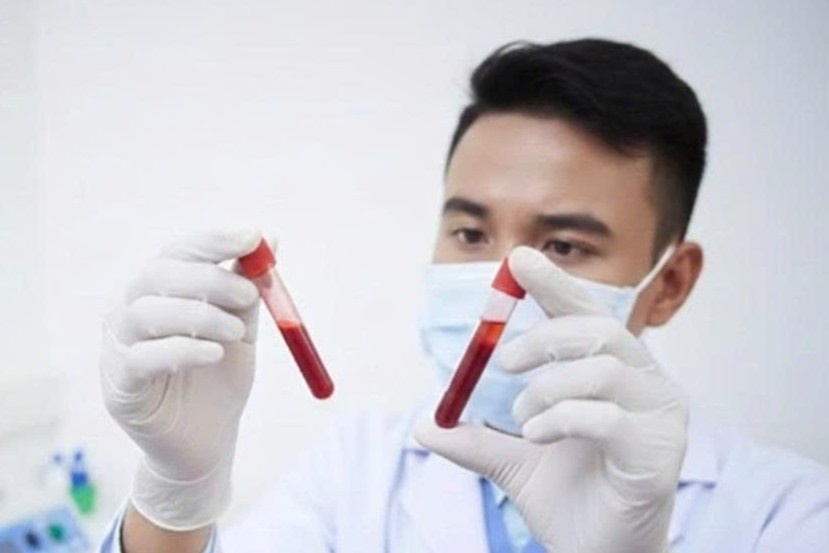 Khoang 42% ca mac HIV o TP.HCM trong nhom 15-29 tuoi hinh anh