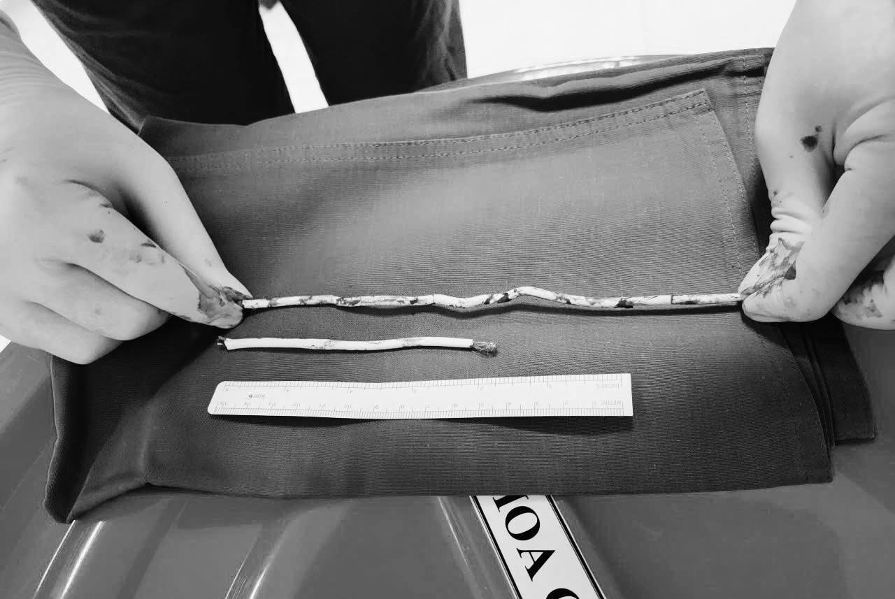 To mo tim cam giac la, nam sinh 15 tuoi cap cuu voi 'cau nho' dau don hinh anh