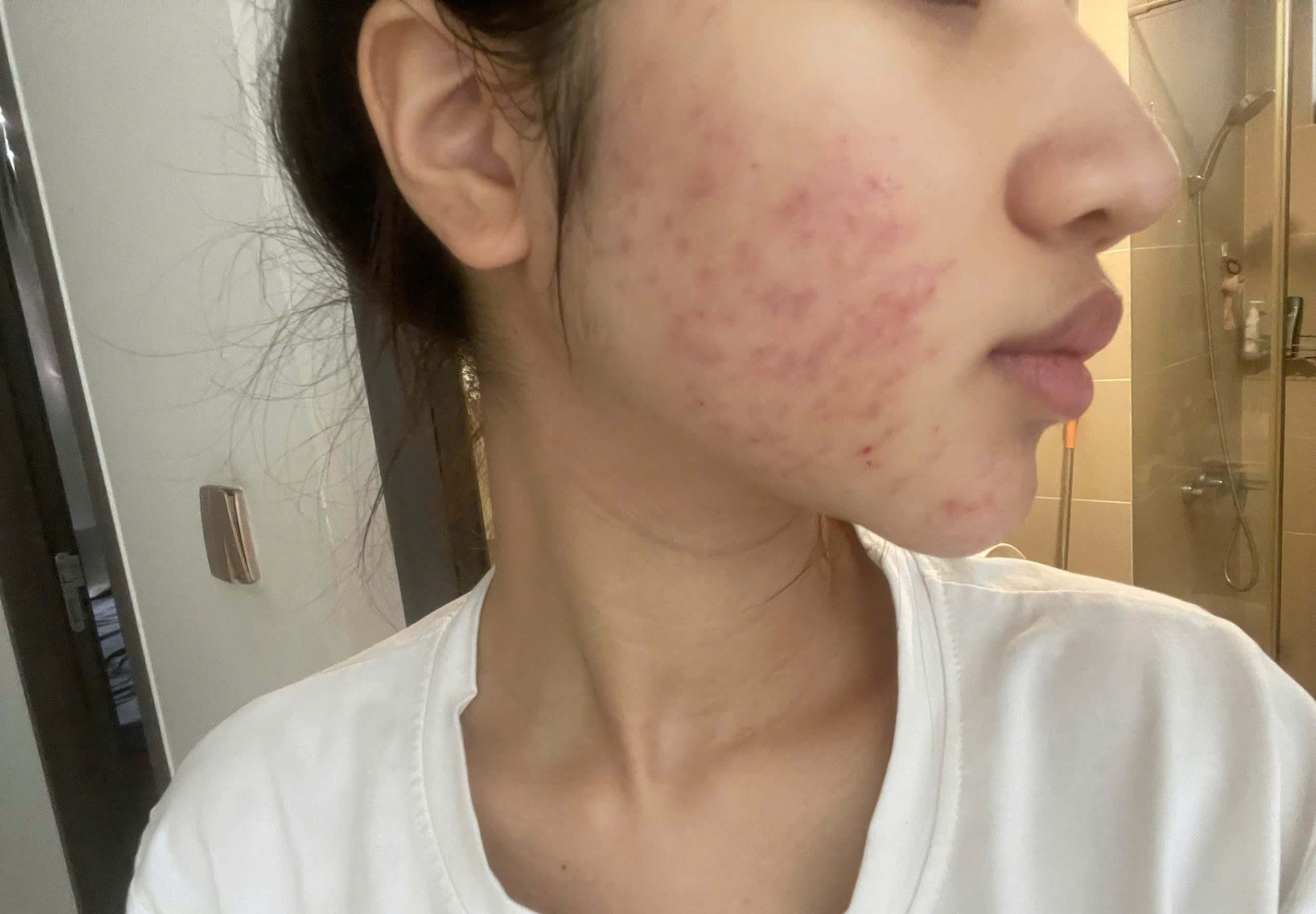 Ganh hau qua vi ap luc lam dep kip Tet hinh anh