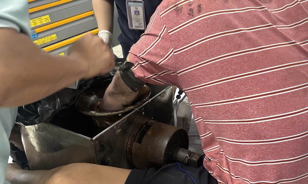 Nguoi dan ong mang may xay thit vao khoa cap cuu o TP.HCM hinh anh