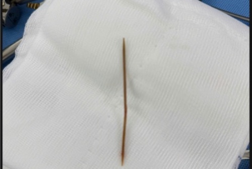 Thoi quen sau bua an anh 3