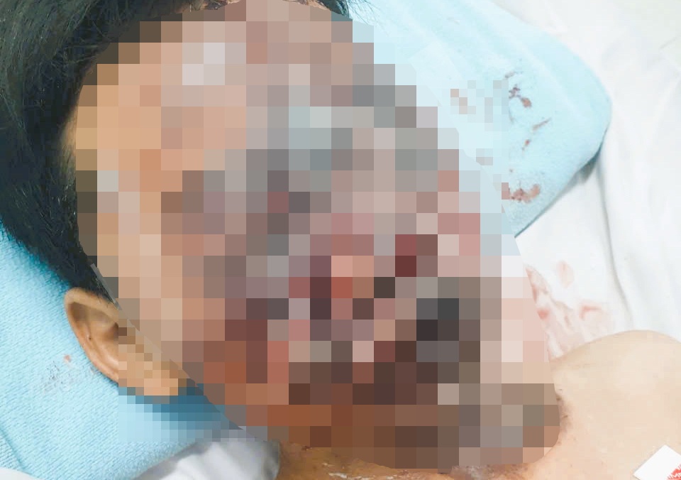 Tro vui khien be trai bong thuong tam toan bo mat hinh anh