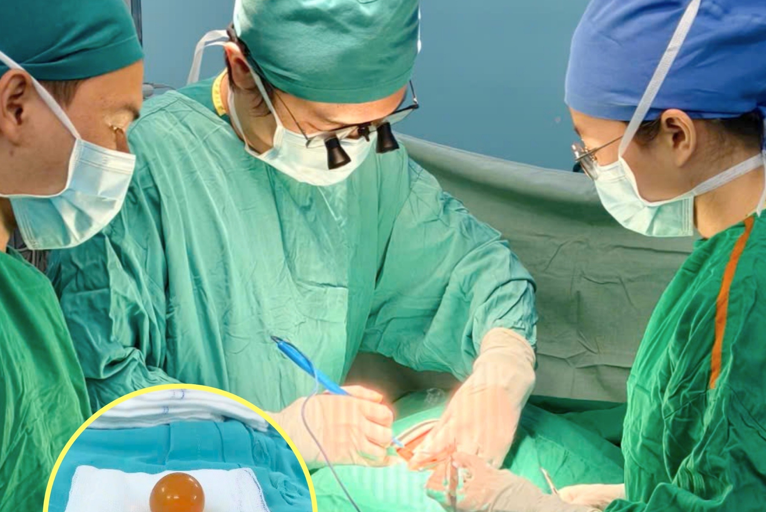 An 'keo la', be gai o TP.HCM bi tac ruot hinh anh