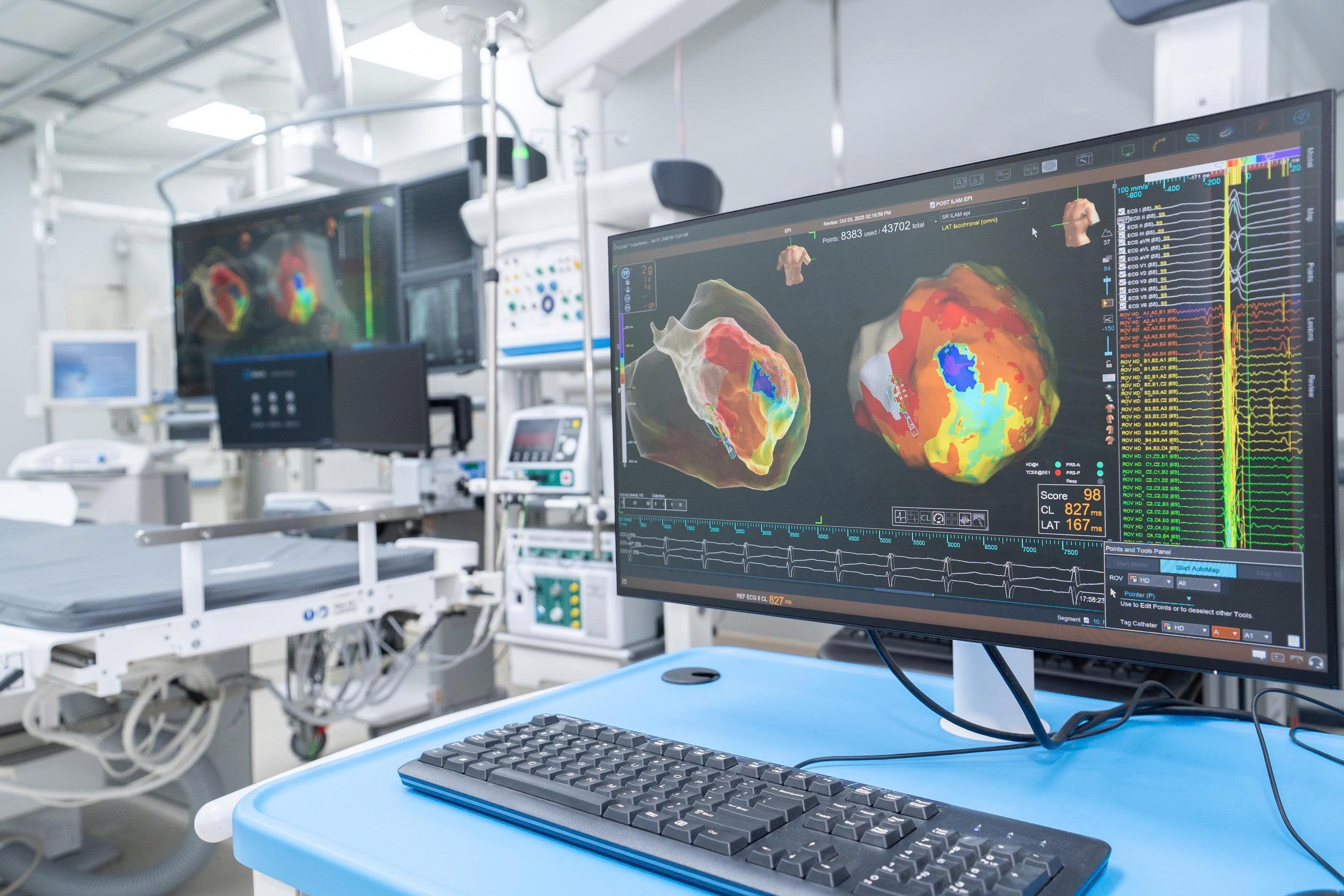 hệ thống thông tim ảnh 1 he thong thong tim anh 1