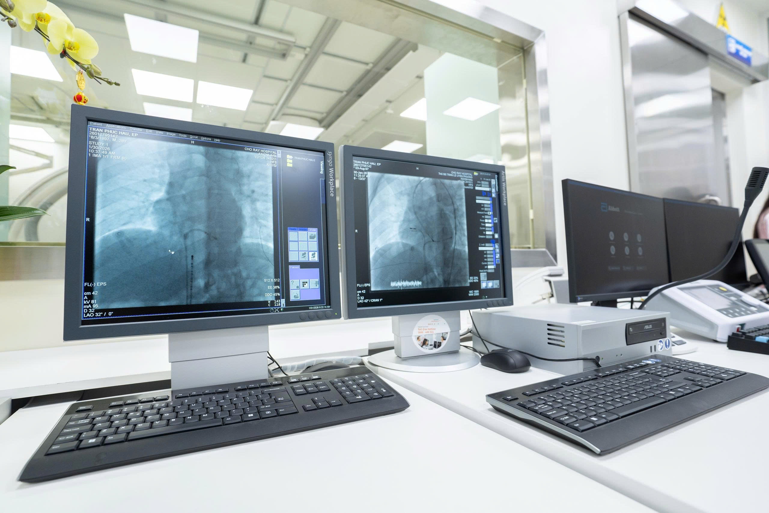 hệ thống thông tim ảnh 2 he thong thong tim anh 2