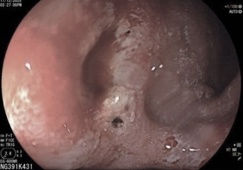 Mot thoi quen 'tu huy' da day rat nhieu nguoi tre mac hinh anh