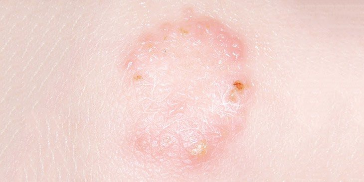 Canh giac nam da lay tu cho, meo hinh anh