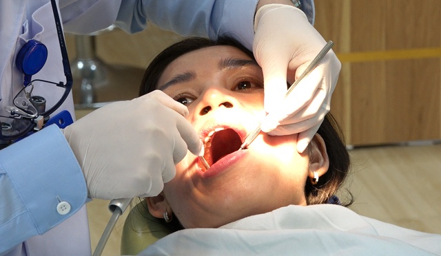 Nen lay cao rang bao lau mot lan? hinh anh