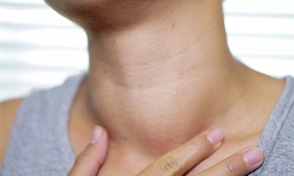 Ung thu tuyen giap tang nhanh: Dung ngo lo 'tin hieu la' o vung co hinh anh