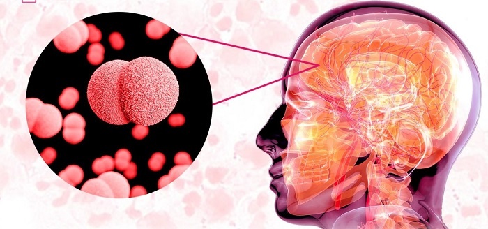 Viem nao mo cau lay truyen nhu the nao va dau hieu nhan biet dac trung hinh anh