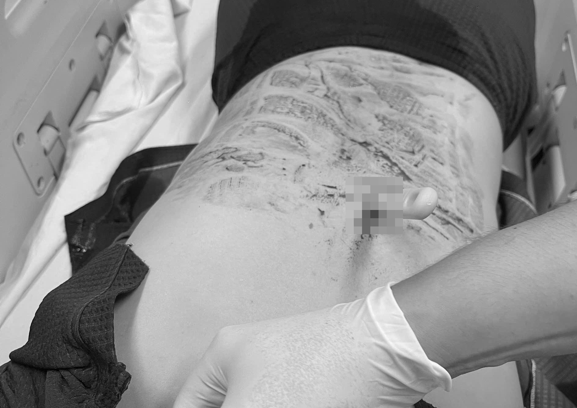 Nguoi phu nu nhap vien voi con dao Thai Lan cam chat vao lung hinh anh