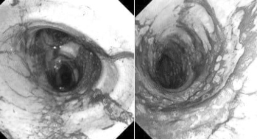 Duong tho day muoi than cua 2 nguoi song sot sau vu chay o TP.HCM hinh anh