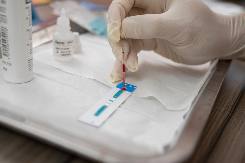 Duong lay HIV tai Viet Nam 'lat leo' phuc tap, ca tre tang nhanh hinh anh