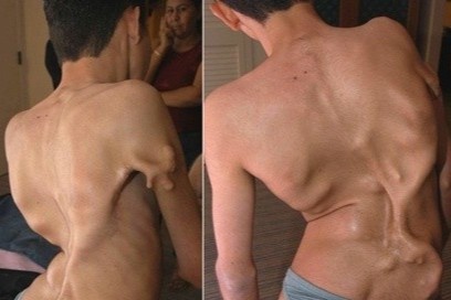 Be gai o TP.HCM mac hoi chung 'nguoi hoa da', trieu nguoi co mot ca hinh anh